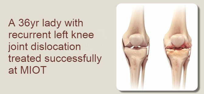 recurrent left knee joint dislocation 